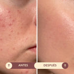 Espuma Facial Limpiadora ANHELI