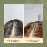 Tratamiento de Aclarado Progresivo ANHELI